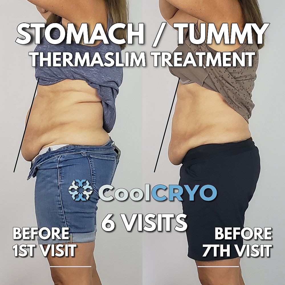 SlimCrystal (Review) Reduces Fat Accumulation! Up to 70% OFF NOW