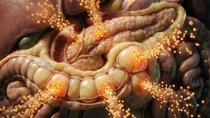 visceral fat - inflammation